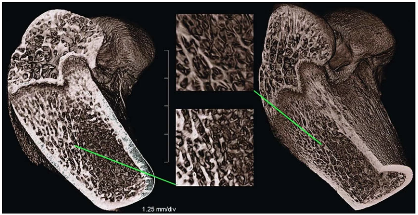 Volume rendering of a murine femur dataset, acquired ex vivo with a continuous scan mode lasting 40s