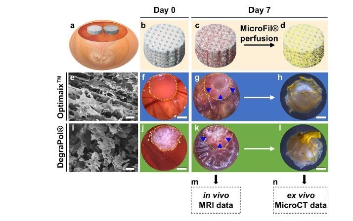 Novel multimodal MRI and Micro-CT imaging approach to quantify angiogenesis and 3D vascular architecture of biomaterials