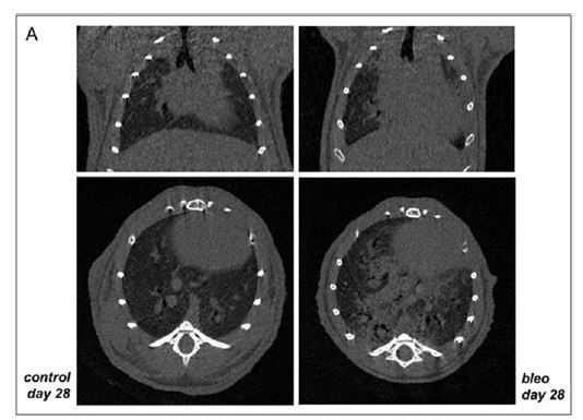 Longitudinal micro-CT provides biomarkers of lung disease that can be used to assess the effect of therapy in preclinical mouse models, and reveal compensatory changes in lung volume