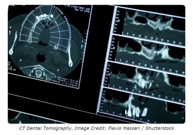 Micro CT Applications in Dentistry