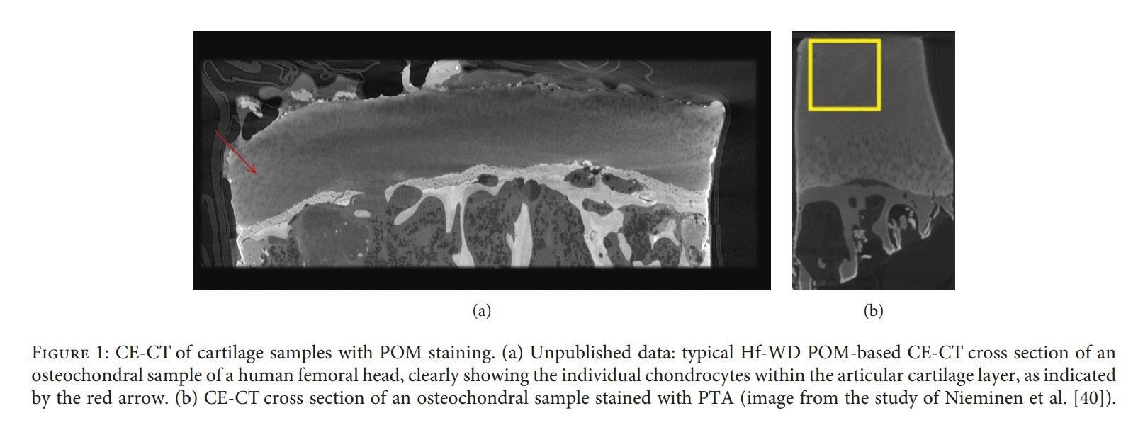 Contrast-Enhanced Micro-CT for Virtual 3D Anatomical Pathology of Biological Tissues: A Literature Review