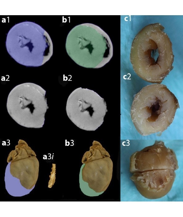 Micro-CT scan with virtual dissection of left ventricle is a non-destructive, reproducible alternative to dissection and weighing for left ventricular size