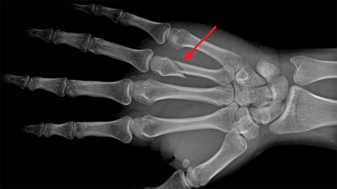 What do you know about X-ray and its applications?