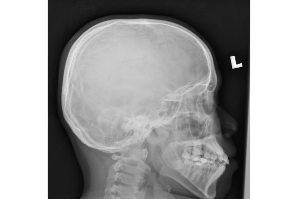 X-ray Based Imaging Modalities