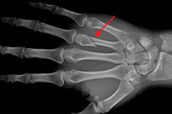 What do you know about X-ray and its applications?